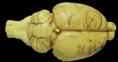 تجربة ثورية.. باحثون يدرّبون خلايا عصبية حية لتنفيذ مهام ذكاء اصطناعى